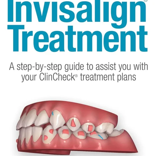 Insider's Guide to Invisalign Treatment: A step-by-step guide to assist you with your ClinCheck treatment plans