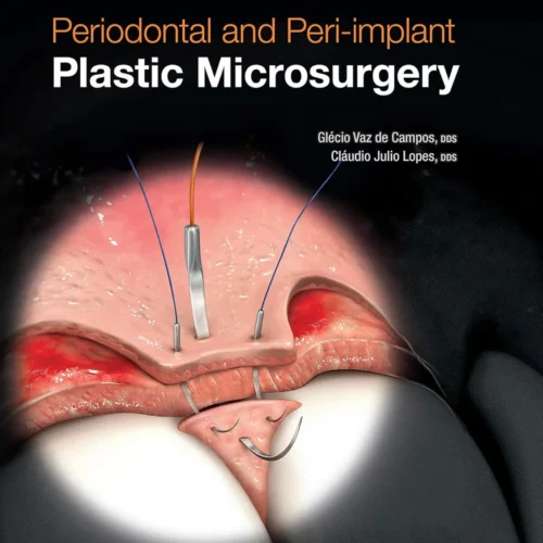Glecio Vaz de Campos, Claudio Julio Lopes - Periodontal and Peri-implant Plastic Microsurgery_ Minimally Invasive Techniques with Maximum Precision (2021, Quintessence Publishing)