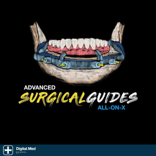Implant Ninja — Advanced Surgical Guides & AoX