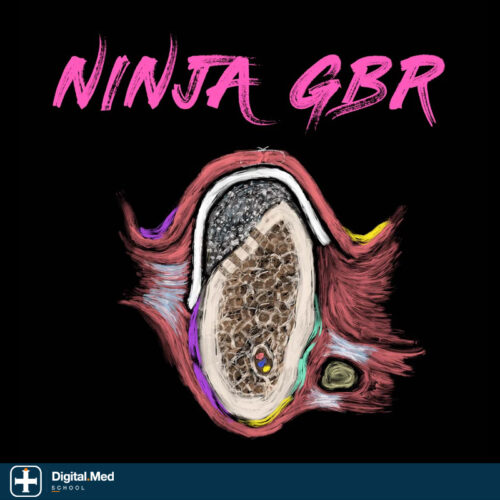 Implant Ninja — GBR
