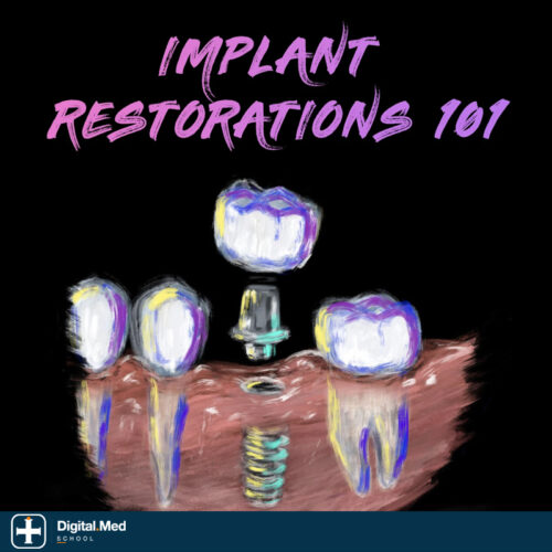 Implant Ninja — Implant Restorations 101