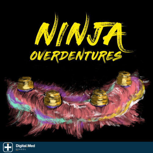 Implant Ninja — Ninja Over-Dentures