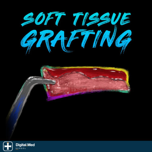 Implant Ninja — Soft Tissue Grafting Course
