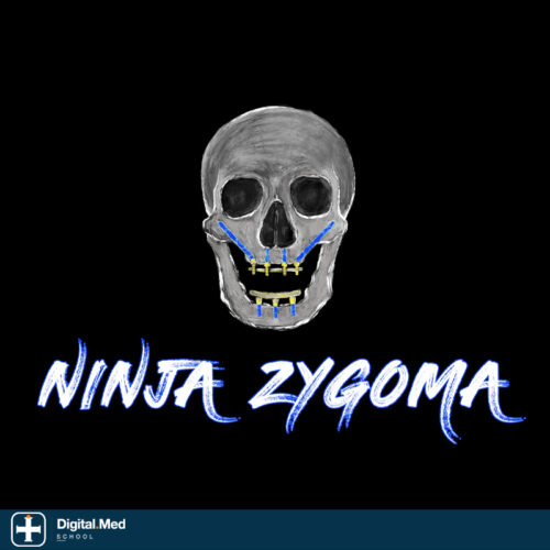 Implant Ninja — Zygomatic Implants