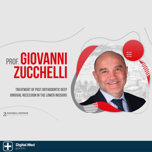 Post-Orthodontic Deep Gingival Recession in Lower Incisors — Zucchelli