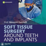 Soft Tissue Surgery Around Teeth and Implants — Zucchelli
