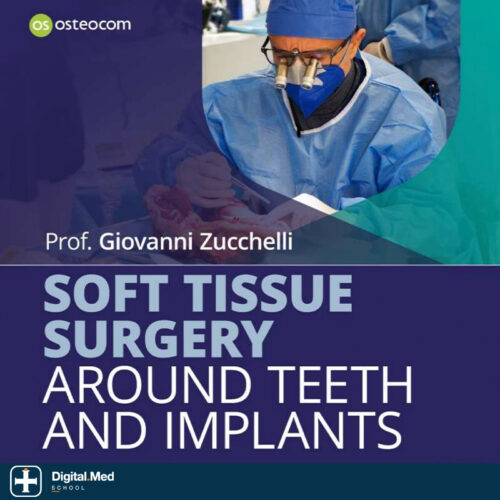 Soft Tissue Surgery Around Teeth and Implants — Zucchelli